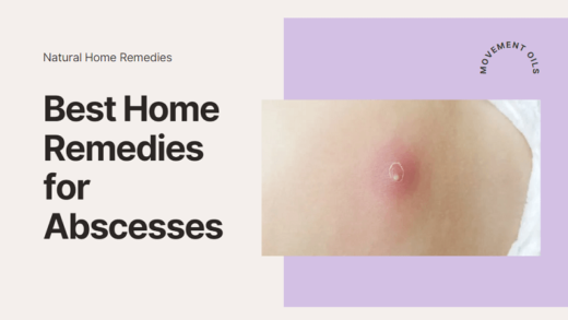 Best Home Remedies for Abscesses